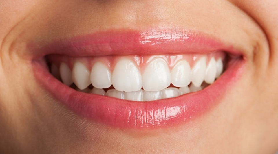 About Teeth Whitening & Cleaning