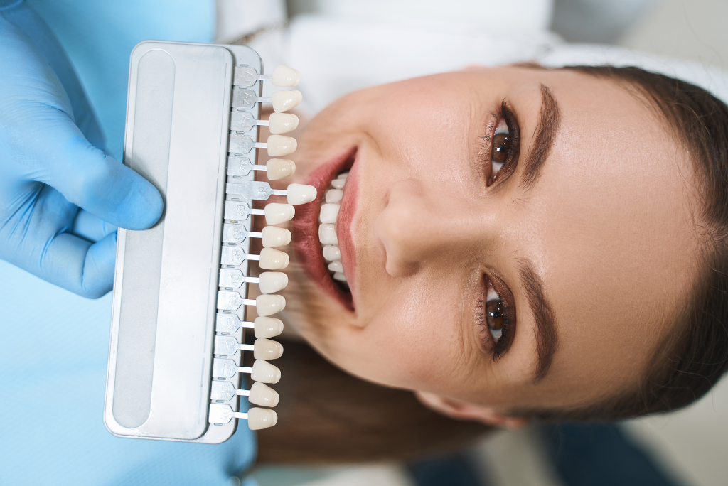 What & Why Choose Natural Laminate Veneers?